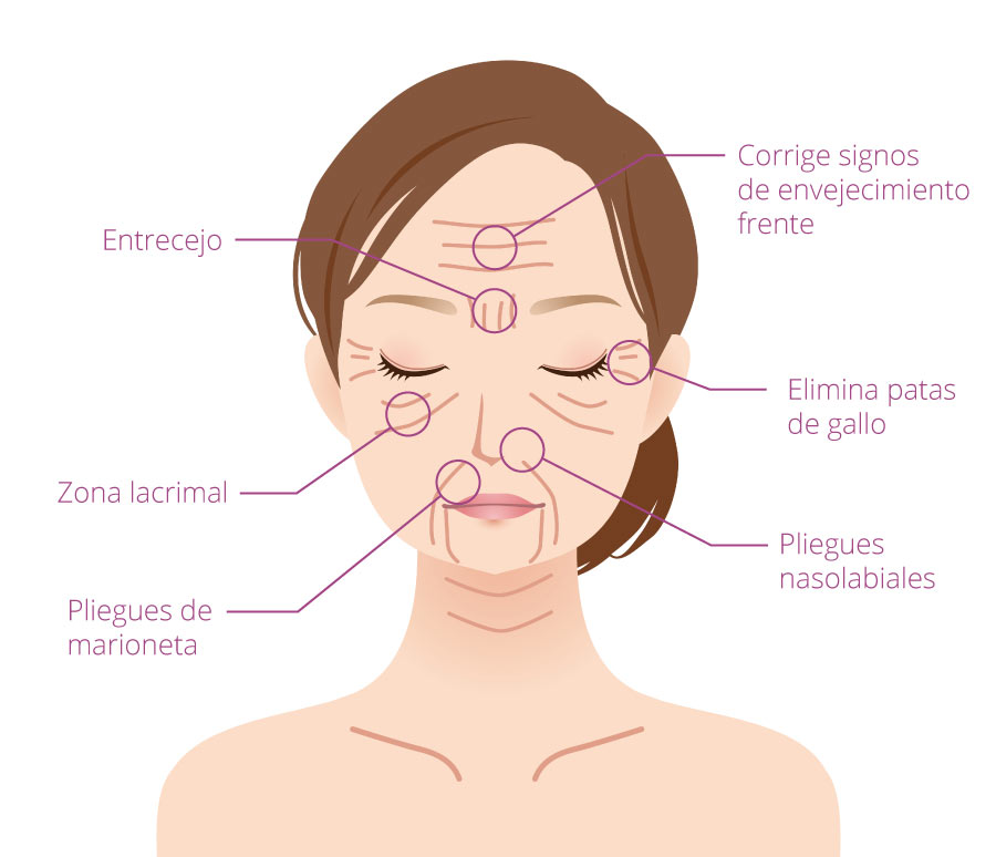 verdades sobre el botox