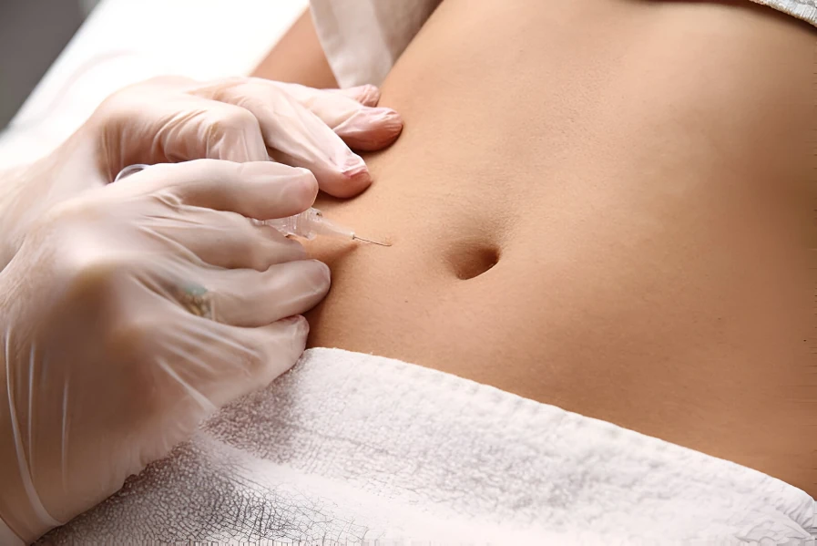 Beneficios de la Carboxiterapia