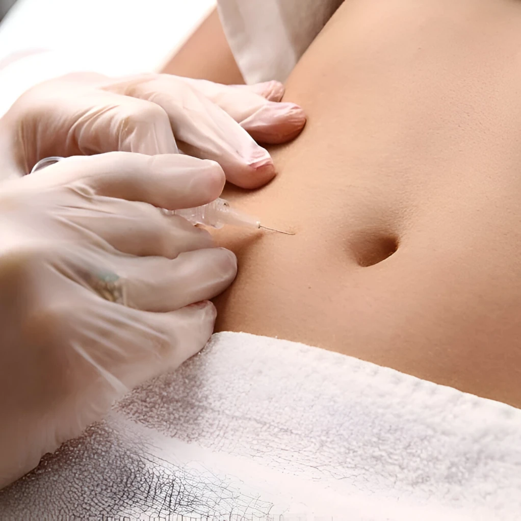 Carboxiterapia corporal