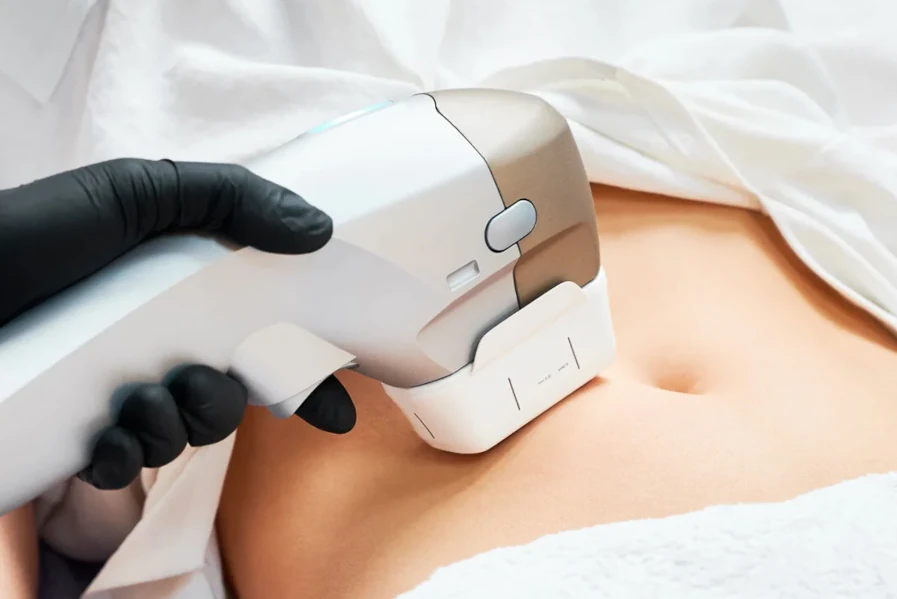 Beneficios del Liftage coprporal con Hifu