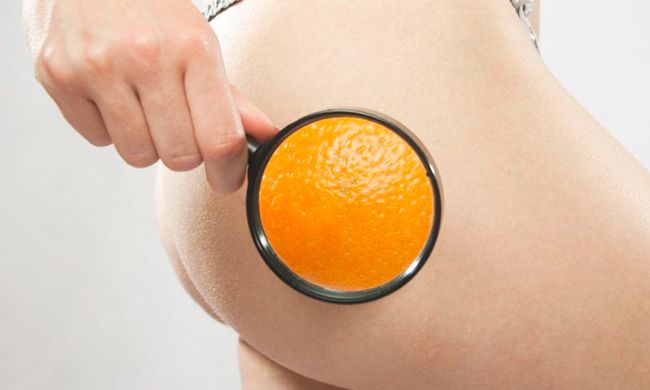 piel-de-naranja