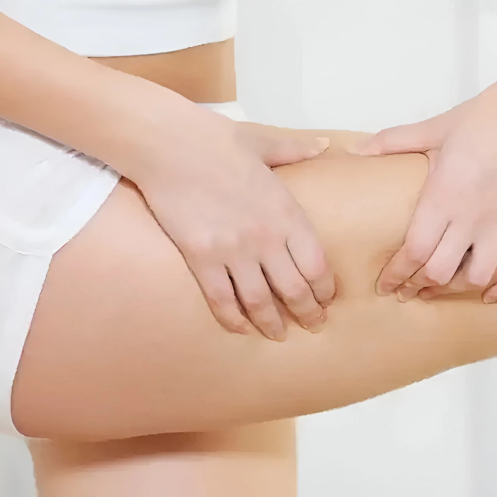 Reducir celulitis Zaragoza