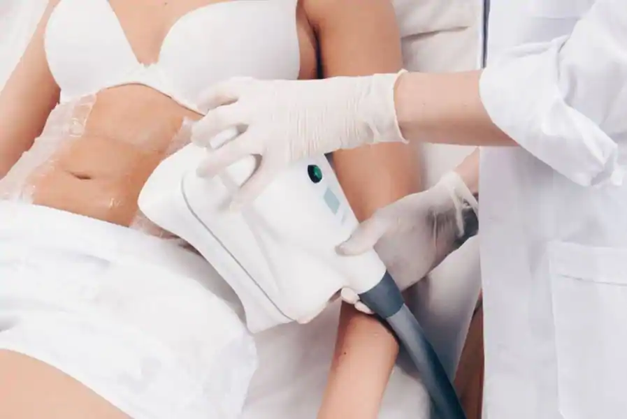 Tratamiento de Crioterapia para reducir abdomen.
Reducción de Grasa Localizada sin Cirugía